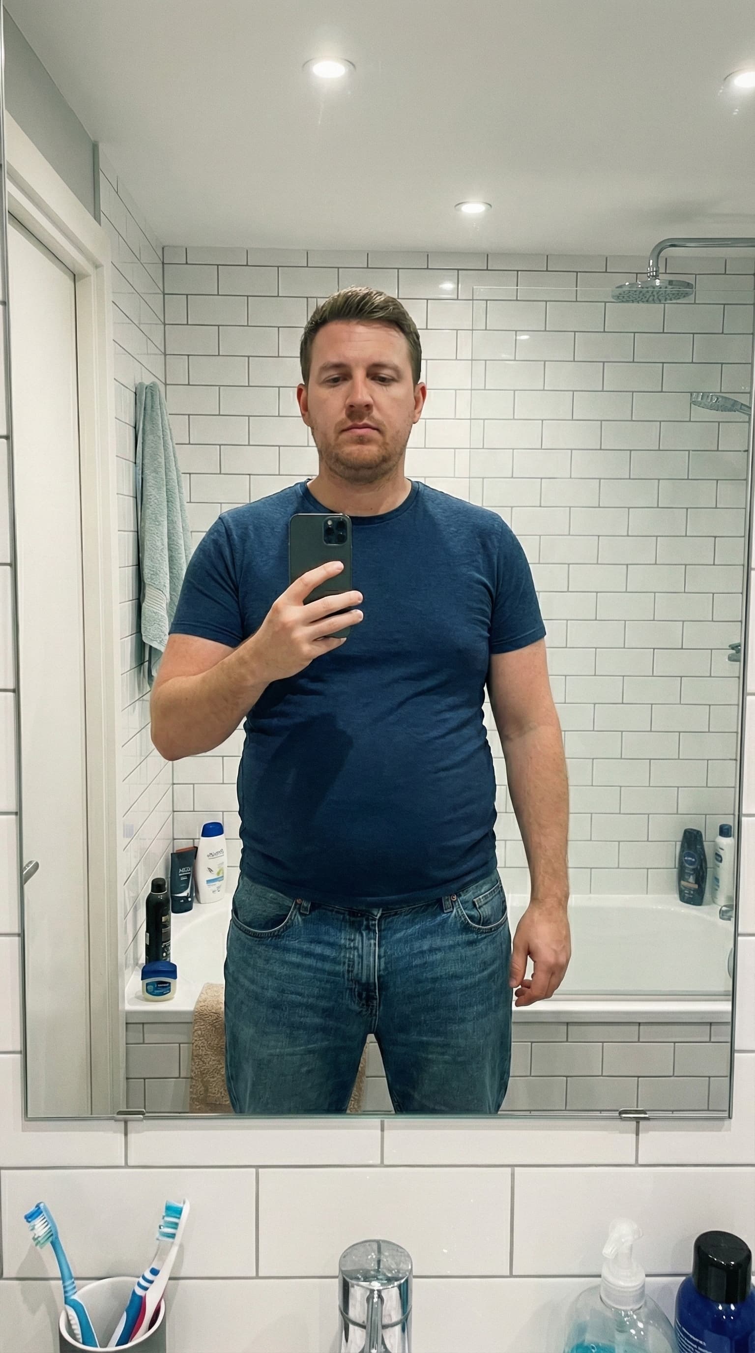 Before weight loss transformation